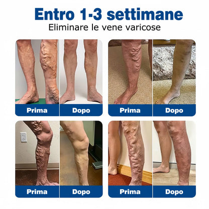 Aggiungi il secondo e risparmia il 30% 💖